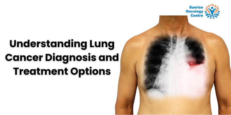 best lung cancer treatment Sunrise oncology cancer center Mumbai