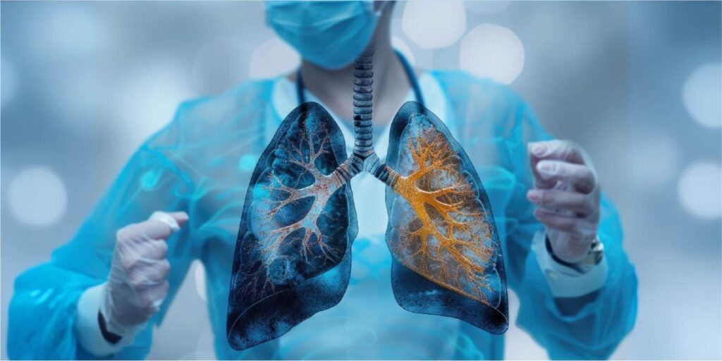 lung cancer treatment in Mumbai